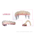 Full Arch Zirconia Malo Bridge